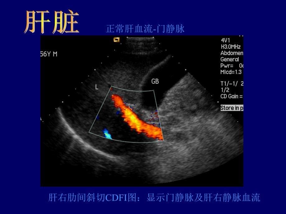 b超影像图谱_第5页