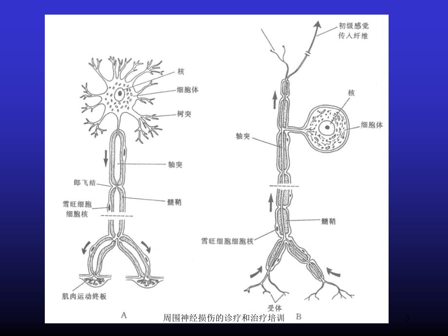 周围神经损伤的诊疗和治疗培训培训课件_第3页